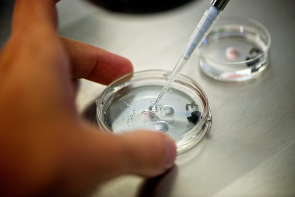 Ученые: Создан тест для выбора эмбриона на ЭКО с высоким IQ