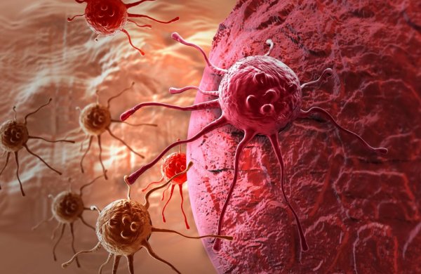 Ученые открыли новый метод распознания рака и активной борьбы с ним